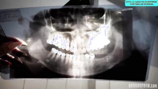 Dentista aterrador - angel wicky, nicole love Sub Esp